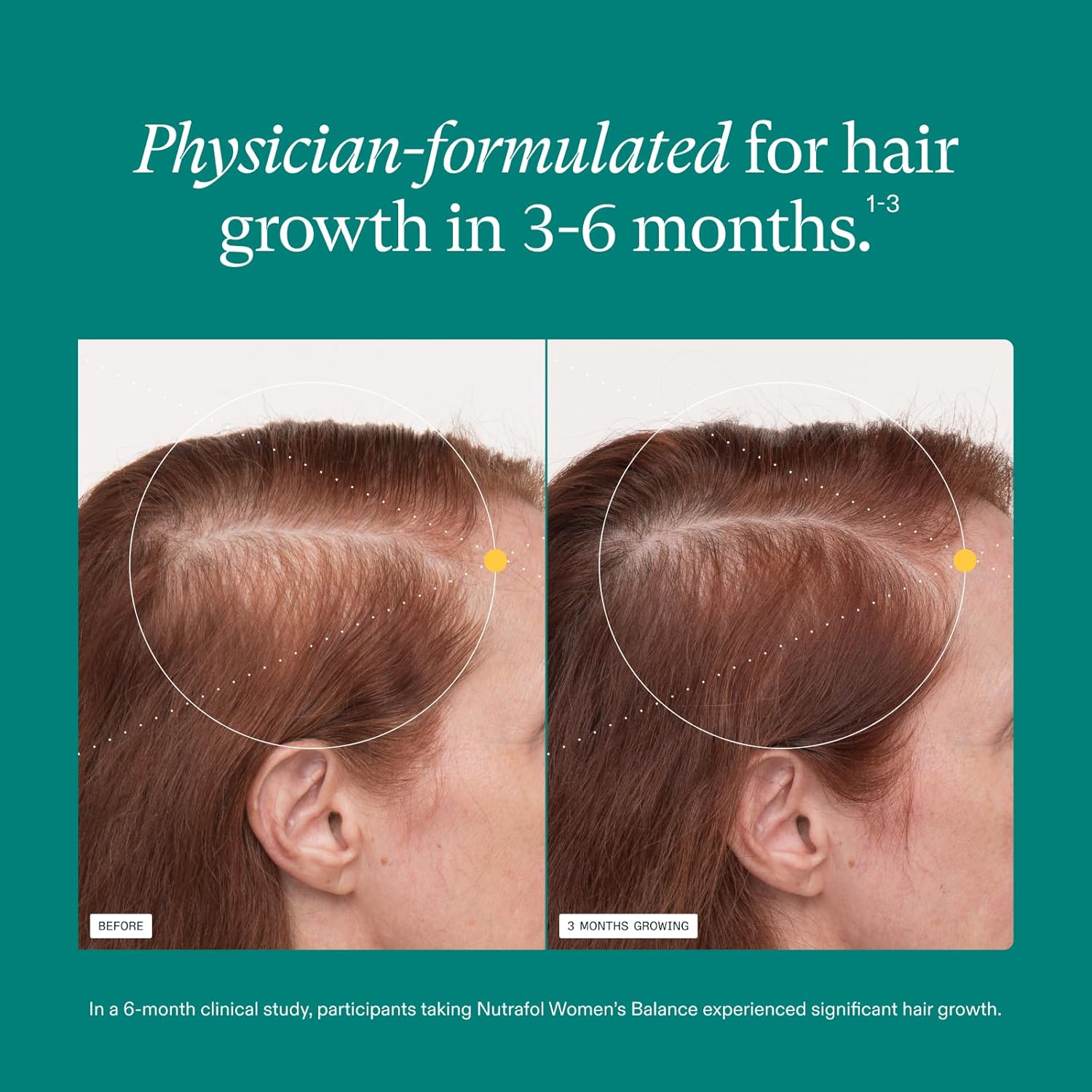 Nutrafol Women’s Balance Hair Growth Supplement – Ages 45+ – 1 Month Supply